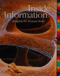 Inside information : imaging the human body / William A. Ewing
